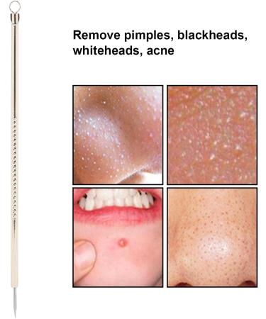 Blackhead Remover Whitehead Acne Removal Stainless Steel Pimple Popper Extractor Tool Portable Acne Removal Tool - Buy Online on GoSupps.com