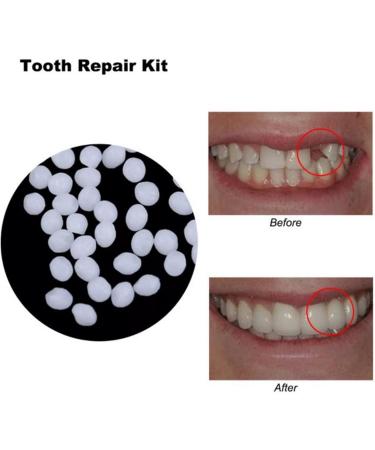 Tomvorks Tooth Repair Granules for Making DIY False Teeth Easy and Natural Tooth with EcoFriendly Material 3 Different Capacities 5g - Buy Online on GoSupps.com