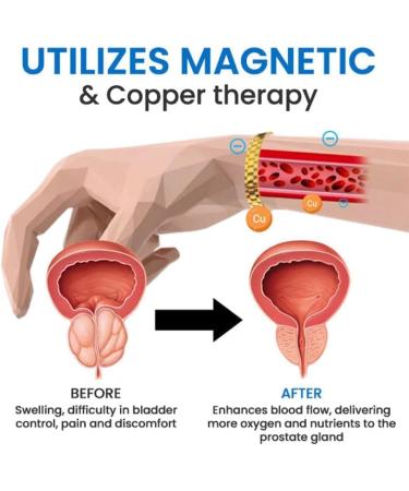 Magnetic Copper Prostate Band Prostate Wristband Magnetic Copper Prostate Bracelet Improves Blood Circulation Black - Buy Online on GoSupps.com