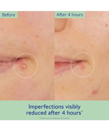 Caudalie Vinopure Targeted Spot Solution with Salicylic Acid - 15 mL - Buy Online on GoSupps.com