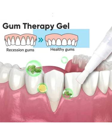 Taileden Gel Taileden Gum Therapy Gel Taileden Gum Therapy Gel Taileden Gum Care Gel Gum Shield Therapy Gel Gum Therapy Gel for Recessed Gums Teeth Whitening Essence Pen (1pcs) - Buy Online on GoSupps.com