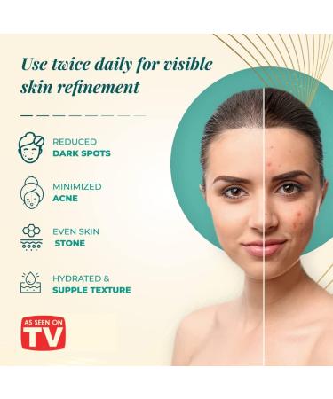 VoilaVe Hyaluronic Acid Serum | Anti-Aging & Hydrating Face Serum with Vitamin C | Reduce Dark Spots & Acne | Wrinkle-Reducing & Brightening 1 Oz - Buy Online on GoSupps.com