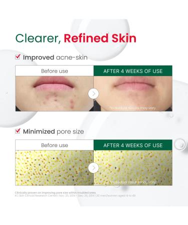 Dr. G R.E.D. Blemish Clear Hyal-Cica Soothing Serum - Korean Skincare - Long-Lasting Hydrating Serum for All Skin Types - Cools Skin Temperature - Hyaluronic Acid & Centella Asiatica - 1.69 fl oz - Buy Online on GoSupps.com