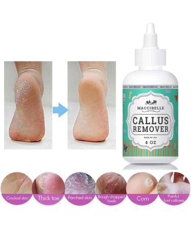 Maccibelle EXTRA STRENGTH Callus Remover Gel - Professional Foot Treatment for Corns & Calluses - 4 oz Bottle - Fast International Shipping - Buy Online on GoSupps.com