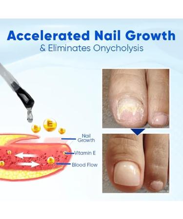 Biancat OnyxoGuard Nail Growth and Repair Serum OnyxoGuard Serum Nail Growth Serum Nail Growth and Strengthener Nail Serum Repair Essence Nail Strengthener for Thin Nails and Growth (2pcs) - Buy Online on GoSupps.com