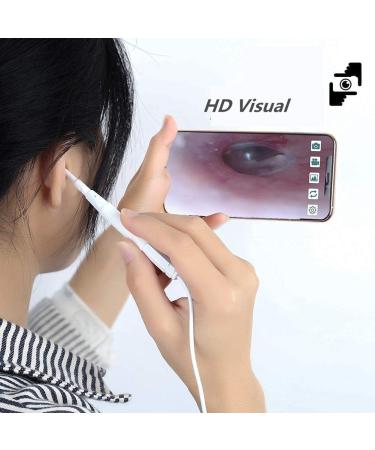 Marycan Ear Wax Remover HD View Otoscope with Light - 6 Adjustable LED Lights for Adults, Kids & Pets - Buy Online on GoSupps.com