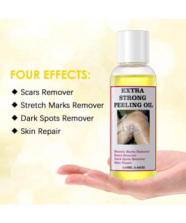 Yellow Peeling Oil for Dark Skin - Strong Extra Strength Exfoliating Solution with Salicylic Sodium Hyaluronate - 110ML/3.66 OZ - Buy Online on GoSupps.com