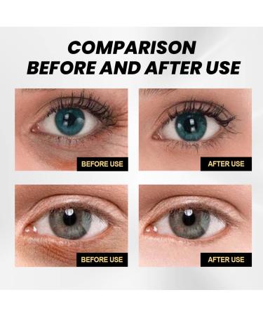 Firming Eye Cream: Instant Eye Tightener for Under-eye Puffiness, Fine Lines, Wrinkles & Dark Circles - Buy Online on GoSupps.com