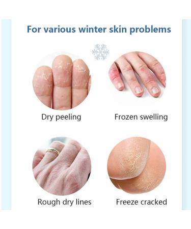 Genryu Anti-Cracking Foot Cream - Intensive Repair for Cracked Heels - 2PCS Set - Buy Online on GoSupps.com