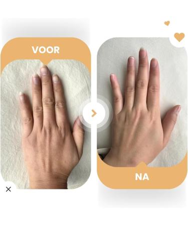 CTEC IK 8 Set Moisturizing and Repairing Foot and Hand Cream Kombucha Hyaluronic Acid and Niacinamide All skin types Without parabens or sulphates 2x100g - Buy Online on GoSupps.com