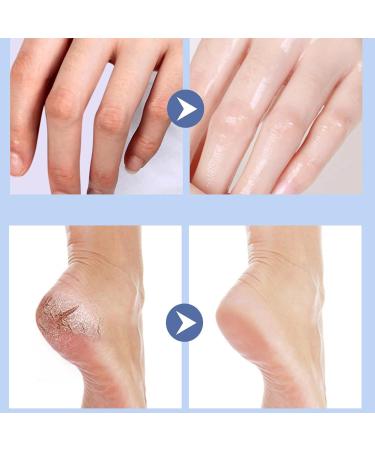 Cr me Hydratante Et Anti-Ger ures for Les Pieds Cr me R paratrice for Les Mains Et Les Pieds Masques Hydratants Et Anti-Ger ures for Les Pieds Les Genoux Les Coudes Et Les Callosit s Des Mains(Uns Unscented - Buy Online on GoSupps.com