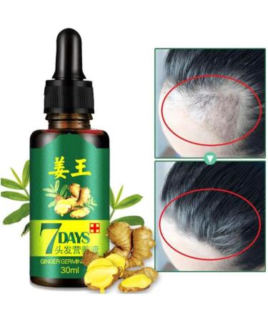  Kingknow Hair Growth Essential Oil Natural Ginger for Hair Loss Treatment Hair Growth Care Ginger Essential Oil Nourishing for Dry Damaged Hair Growth Care 30ml - Buy Online on GoSupps.com