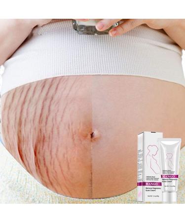 Best Stretch Mark Cream for Pregnancy & Postpartum - Repair & Remove Scars - Buy Online on GoSupps.com