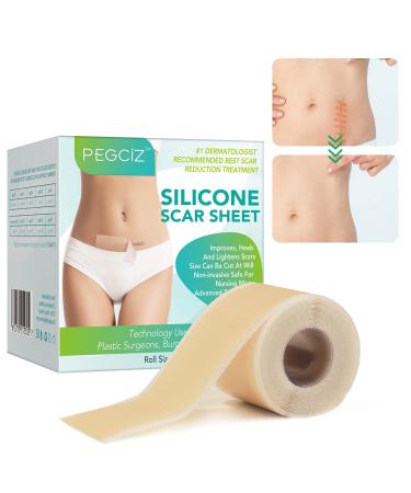 Silicone Scar Sheets  Silicone Scar Tape Strips Scar Removal Sheets Professional Soften and Flattens Scars Caused by C-Section  Surgery  Burn  Keloid  Acne and More(1.6  x 120 ) (1.6  x 120 -3M Roll)