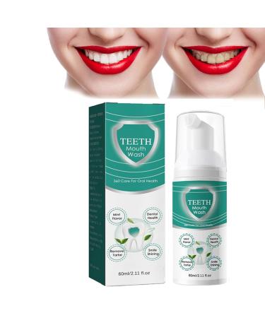 Nouveau bain de bouche meilleur bain de bouche blanchissant les dents soin 360 pour la sant des gencives r sout tous les probl mes bucco-dentaires (1 pi ce) 60 ml (Lot de 1)