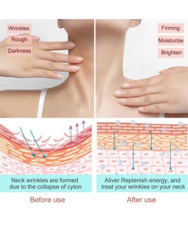 Symmea's Neck Scooter - 2-in-1 Anti-Aging Firming Cream & Massage for Neck Tightening Wrinkle Reduction & Moisturization - Buy Online on GoSupps.com