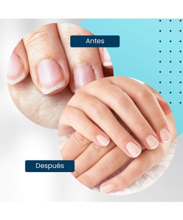  NOOVES NOOVES Nails Cuticle Remover 15 ml Pushes back cuticles Softens and moisturizes cuticles Removes dead skin - Buy Online on GoSupps.com