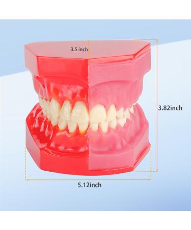 Teeth Eruption Development Model | Visualize Deciduous to Permanent Teeth Transition | International Shipping Available - Buy Online on GoSupps.com