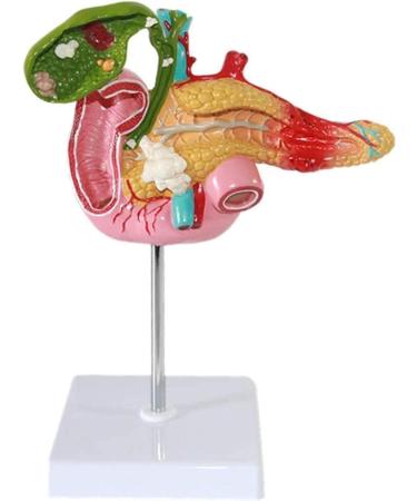 Duodenal Biliary and Pancreatic Model - Duodenal Model - Gallbladder Pathology Digestive System Model Tool Science Teaching Toy Model - Buy Online on GoSupps.com