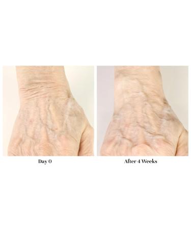 City Beauty Restoring Hand Treatment - Moisturizing Anti-Aging Hand Cream for Dry Hands Wrinkles & Dark Spots - Cruelty-Free & Wash-Resistant Skin Care - Buy Online on GoSupps.com