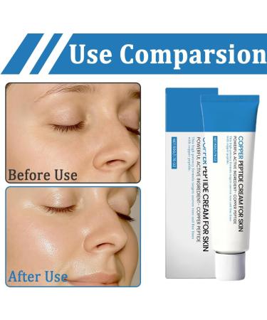 Teegxddy Deep nourishing barrier moisturizing cream quickly penetrates the skin strengthens the skin barrier improves dry wrinkles and finelines gifts for women - Buy Online on GoSupps.com