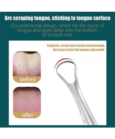 TOUNGE Stainless Steel Tongue Cleaner Scraper Set - 2-Piece for Fresh Breath & Oral Hygiene | Anti-Bad Breath Solution - Buy Online on GoSupps.com