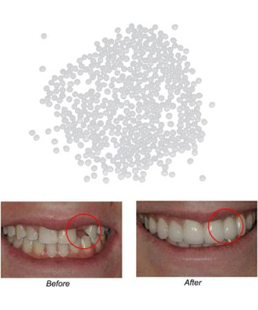 Jojomi Thermo-Pearl Tooth Veneer Set | Temporary Denture Repair for Broken & Missing Teeth | 20g - Buy Online on GoSupps.com