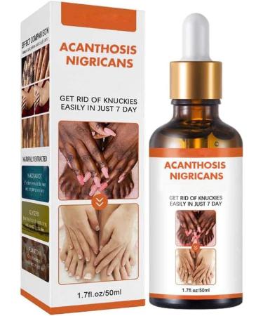 Acanthosis Nigricans Huile de th rapie pour corriger les taches sombres traitement de l'acanthose nigricans limine les taches sombres pour claircir le corps et la peau noire (1 pi ce) 1 pi ce.