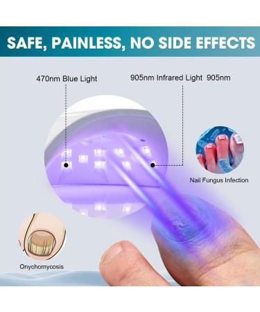 Nail Fungus Light Device - 905nm Infrared & 470nm Blue Light for Toenail & Fingernail Repair | Effective Solution for Damaged & Discolored Nails - Buy Online on GoSupps.com