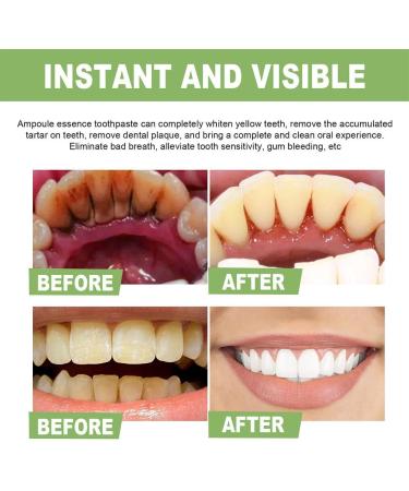Ampoule Toothpaste & Serum - 3V Fruit Acid Tooth Whitening Essence | International Shipping Available - Buy Online on GoSupps.com