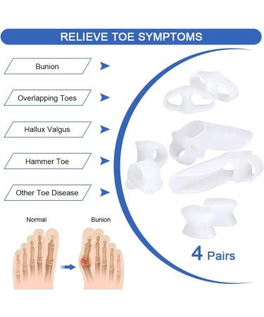 Haofy Toe Spreader Gel Kit - 4 Couples Hallux Valgus & Hammer Toe Corrector for Men & Women | Big Toe Spacers for Bunion Relief - Buy Online on GoSupps.com