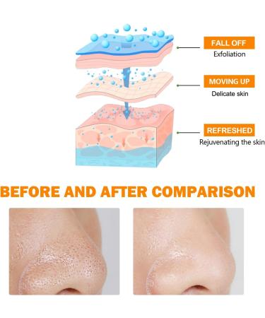  homomdy Orange Exfoliating Gel for Face and Body Natural Orange Exfoliating Gel Facial Scrub Keeps Skin Moisturized Softens Brightens & Moisturizes (1 PCS) - Buy Online on GoSupps.com