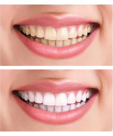 27 Colors Teeth Whitening Shade Guide - Professional Dental Bleaching Chart for Home & Salon Use - Buy Online on GoSupps.com