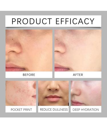 Crsetmyth Rice Pure Essential Toner 120ml Moisture Removing Milk Toner Natural Rice Face Toner Glow Toner Facial Pore Refining Facial Toner for Dry Skin Repair Sie Die Hautbarrie - Buy Online on GoSupps.com