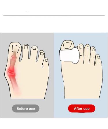 ALINZO Bunion Corrector & Relief Sleeve with Gel Pads - 1 Pair for Big Toe Pain Relief & Realignment- Men & Women - Buy Online on GoSupps.com