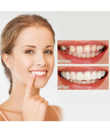 Comioke Prostheses Fake Teeth - 4 Pairs of Temporary Cosmetic Teeth Durable Dentures & Veneers for Enhanced Smile - Buy Online on GoSupps.com