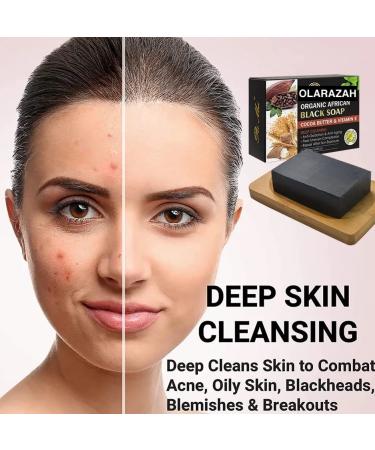 Natural African Black Soap with Cocoa Butter & Vitamin E - Paraben-Free Vegan Gentle for All Skin Types (Lot of 2 - Buy Online on GoSupps.com