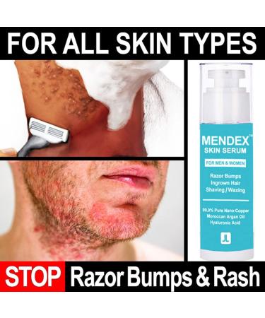 MENDEX Skin Serum After Shave Argan Oil | Razor Bumps & Burn Relief | Ingrown Hair & Itching Treatment | Alcohol-Free | Made in USA | 2.7oz | Ideal for Men & Women - Buy Online on GoSupps.com