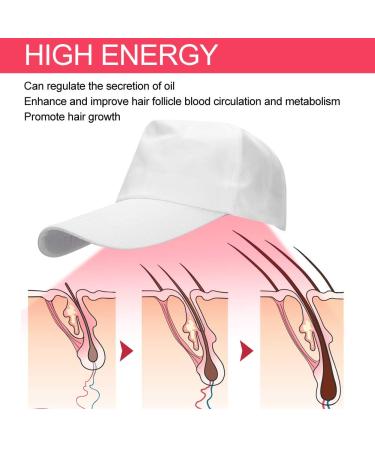 Therapy Alopecia Helmet for Hair Growth | 108 Lamp Beads | Anti-Hair Loss Treatment - International Shipping Available - Buy Online on GoSupps.com