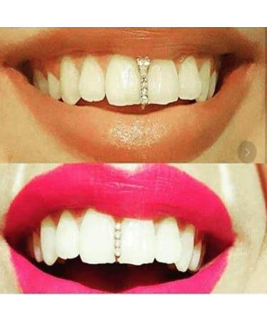 2023 Gold Plated Dental Hip Hop Tooth Rhinestone Top Bottom Dental Teeth Ornament Jewelry Tooth Decoration - Buy Online on GoSupps.com