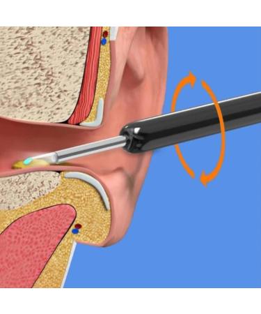 Wireless Ear Wax Removal Tool Kit with 1080P HD Camera - LED Light, 4 Ear Spoons - for Adults, Kids, Pets - Black - Buy Online on GoSupps.com