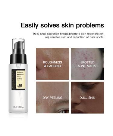 Snail Mucin Serum 96% | Hyaluronic Acid Essence for Skin Repair Dark Spot Treatment & Vitality 3.38 Fl. Oz - Buy Online on GoSupps.com