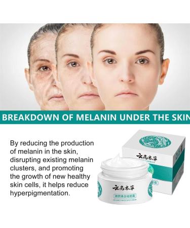 Cr me pour le visage Melasma Taches de rousseur Cr me r novatrice pour la peau fonc e Cr me cosm tique pour le visage peau noire Yunnan Japanese Melasma Cream For All Skin Types (1pcs) - Buy Online on GoSupps.com
