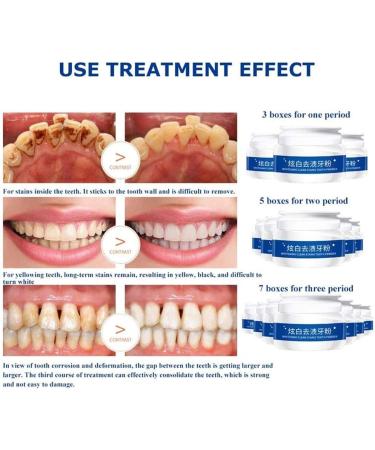 Snow Forest Tooth Elevator Powder - 30g | Remove Coffee Stains & Whiten Teeth | International Shipping - Buy Online on GoSupps.com