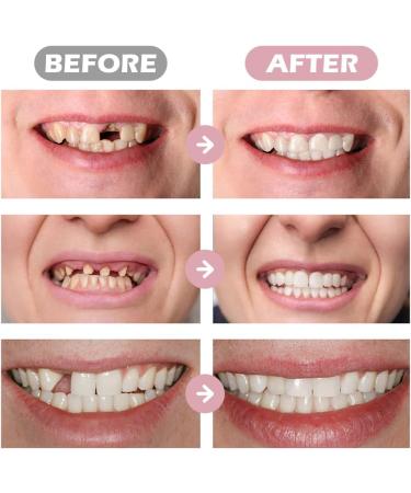 84 pcs Teaching Mold False Teeth DIY Acrylic Resin Denture Upper Lower Temporary Crowns Fake Tooth Cosplay Costume False Teeth for Halloween Makeup Party Ornament Supplies (Slightly Yellow) - Buy Online on GoSupps.com