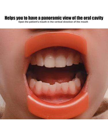 3pcs O-Shape Lip Retractor Opener - Enhance Oral Care with Mouth Cheek Lip Accessories for Dental Procedures - Buy Online on GoSupps.com