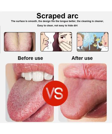 CUZYP Set of 3 Tongue Cleaners | Best Tongue Scrapers for Dry Mouth Relief | Improve Oral Hygiene - Buy Online on GoSupps.com