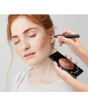 Lifenaxx WLAN Otoscope LX-032 - High-Quality Wireless Ear Inspection Camera | Shop Internationally - Buy Online on GoSupps.com