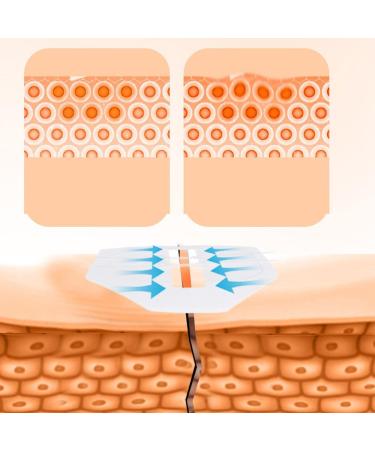 Sutures Adhesive Bandages 2 PCS - Surgical Laceration Repair Quick Clot Emergency Wound Closure Device 2.8 Inch - Buy Online on GoSupps.com