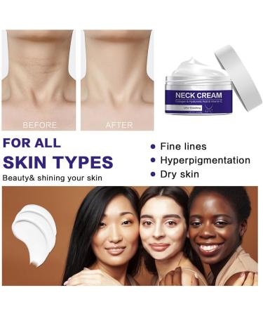 2024 New Tighten & Lift Firming Neck Cream Ultra-Smoothing Neck Cream Anti-Aging Neck Cream Neck Firming Cream For Sagging And Tighten (2Pcs) - Buy Online on GoSupps.com